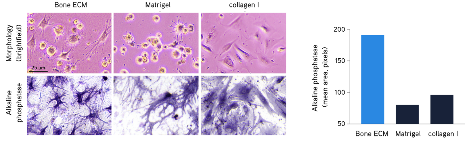 Primary human osteoblasts cultured in Bone dECM Hydrogel (6 mg/mL) show characteristic dendritic morphology after 1 hour in culture. Osteoblasts displayed higher alkaline phosphatase activity in Bone dECM Hydrogels than in Matrigel<sup>®</sup> matrix or collagen I after 7 days in culture. Primary human osteoblasts culture.