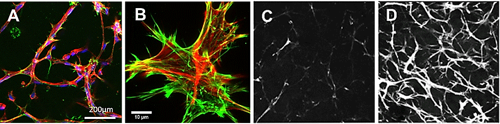 TrueGel® HTS hydrogels and collagen deposition using seeded fibroblasts TrueGel® HTS hydrogels and collagen deposition using seeded fibroblasts