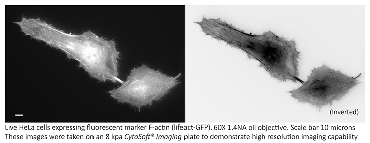 Fluorescent cell imaging of F-actin in HeLa cells using CytoSoft® imaging plates (8 kPA). Cell migration and adhesion can be analyzed by monitoring the expression of F-actin filamentous cytoskeleton protein. Fluorescent cell imaging of F-actin in HeLa cells using CytoSoft® imaging plates (8 kPA). Cell migration and adhesion can be analyzed by monitoring the expression of F-actin filamentous cytoskeleton protein.