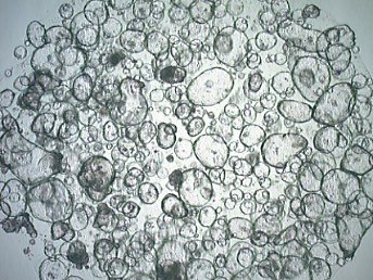 Human colon organoids Human colon organoids