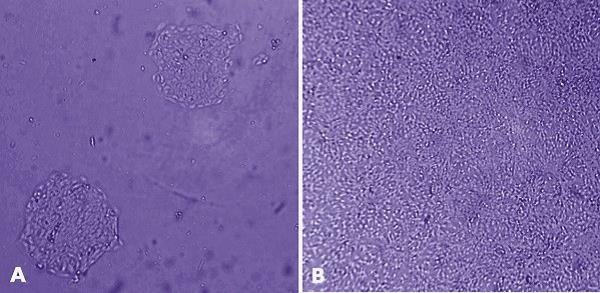 MaxGel™ ECM enables improved expansion of adult keratinocytes. MaxGel™ ECM enables improved expansion of adult keratinocytes.