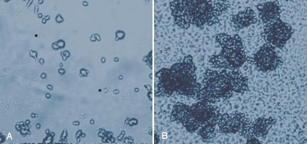 MaxGel™ ECM provides an excellent substrate for neural stem cells.  MaxGel™ ECM provides an excellent substrate for neural stem cells.