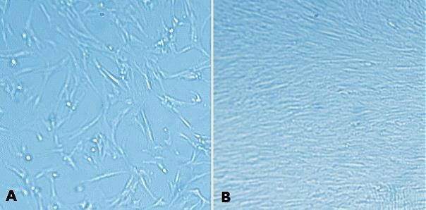 MaxGel™ ECM enables improved expansion of MRC-5 cells. MaxGel™ ECM enables improved expansion of MRC-5 cells.