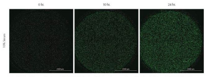 rock-science-Figure-11-Kinetic-images Kinetic images taken of Green-labeled MDA-MB-231 cells labeled prior to experiment with CellTracker™ Green CMFA dye. 10% or 0% serum was used as positive and negative chemoattractant controls, respectively. Images captured using GFP imaging filter cube and a 4X objective.