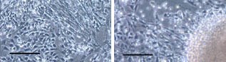 EB Selection in defined medium. Morphology of putative NSCs produced from iPSCs cells by various protocols. Scale bar: 100 µm.  EB Selection in defined medium. Morphology of putative NSCs produced from iPSCs cells by various protocols. Scale bar: 100 µm.
