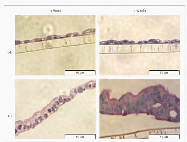 Haematoxylin-eosin stain of Calu-3 cells at the L-L and A-L interfaces after 1 week and 3 weeks in culture. Haematoxylin-eosin stain of Calu-3 cells at the L-L and A-L interfaces after 1 week and 3 weeks in culture.