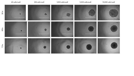 HT-29 Spheroids. Spheroid formation and growth of HT-29 spheroids over time with varying seeding densities. HT-29 Spheroids. Spheroid formation and growth of HT-29 spheroids over time with varying seeding densities.