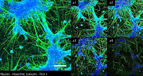 Application of TrueGel® HTS hydrogels in culturing iPSC-derived neural stem cells Application of TrueGel® HTS hydrogels in culturing iPSC-derived neural stem cells