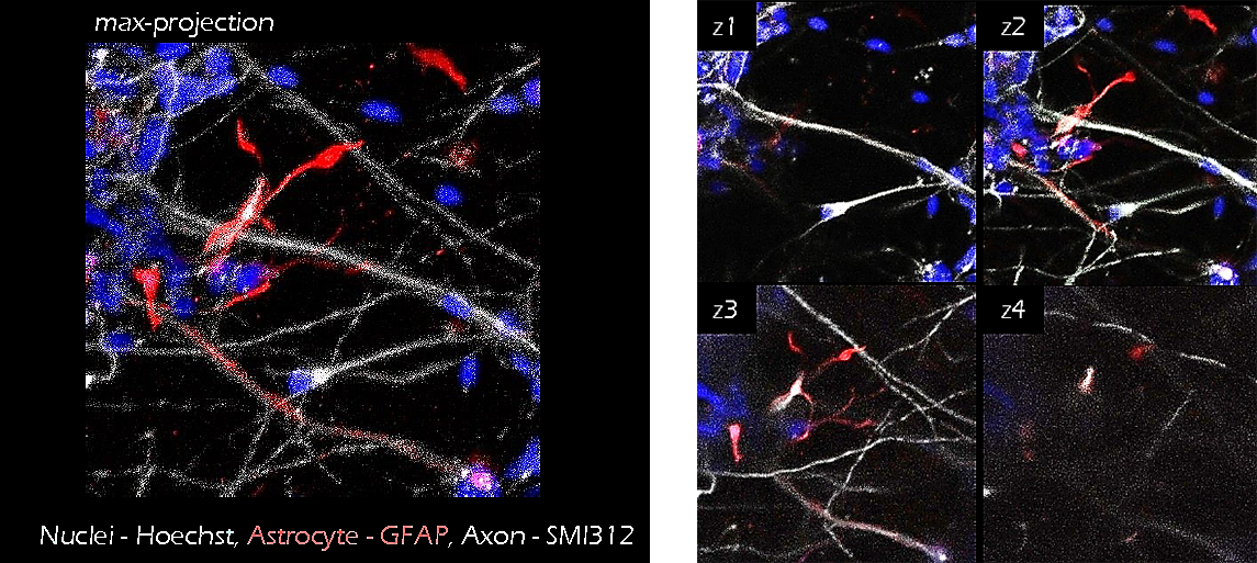 Application of TrueGel® HTS hydrogels in iPS neuron/astrocyte co-cultures Application of TrueGel® HTS hydrogels in iPS neuron/astrocyte co-cultures