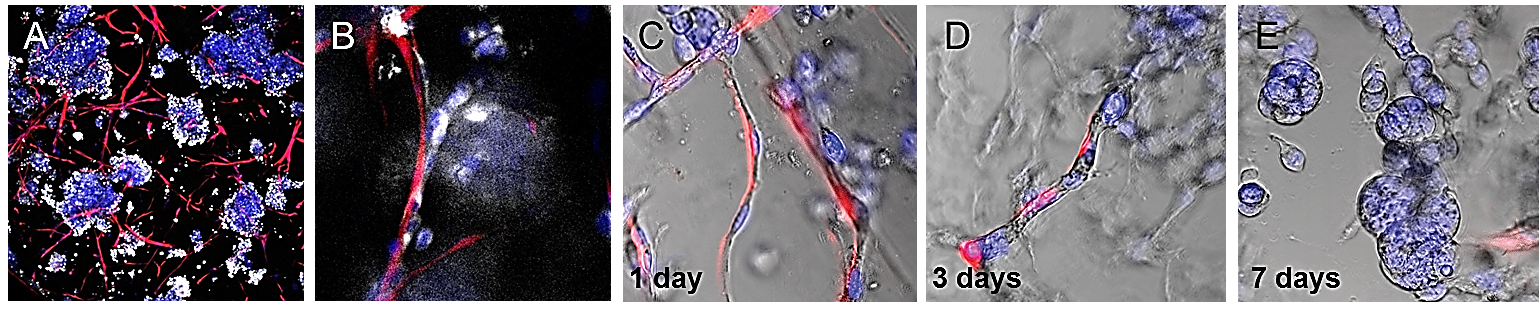 TrueGel® HTS hydrogels and tumor microenvironments TrueGel® HTS hydrogels and tumor microenvironments