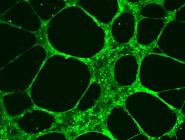 HUVEC Angiogenesis Assay HUVEC Angiogenesis Assay