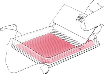 In Vitro Scratch Assay In Vitro Scratch Assay