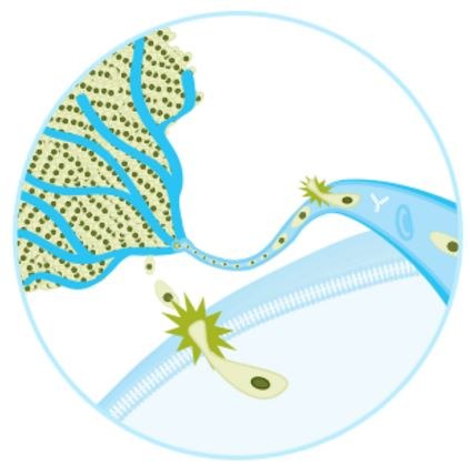 Tumor metastasis is a multistep process involving cancer cell adhesion, cell migration and invasion into neighboring tissues and vasculature Tumor metastasis is a multistep process involving cancer cell adhesion, cell migration and invasion into neighboring tissues and vasculature