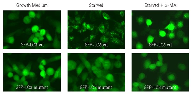 Autophagy inhibitor 3-MA prevents translocation of GFP-LC3 Autophagy inhibitor 3-MA prevents translocation of GFP-LC3