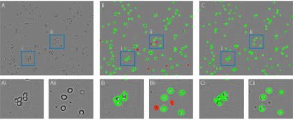 Improvement of the artificial intelligence algorithm of the Corning Cell Counter. (<b>A</b>) unprocessed image. (<b>B</b>) Results of the old algorithm, many cells in clusters are not detected properly and debris is wrongly detected as dead cells. (<b>C</b>) Results of the new algorithm, all individual cells within clusters are detected properly and no debris is detected as dead cells. (<b>Ai-Cii</b>) Zoomed in images of blue boxes containing examples of the improved individual cell detection (<b>i</b>) and dead cell detection (<b>ii</b>). Improvement of the artificial intelligence algorithm of the Corning Cell Counter. A) unprocessed image. B) Results of the old algorithm, many cells in clusters are not detected properly and debris is wrongly detected as dead cells. C) Results of the new algorithm, all individual cells within clusters are detected properly and no debris is detected as dead cells. Ai-Cii) Zoomed in images of blue boxes containing examples of the improved individual cell detection (i) and dead cell detection (ii).