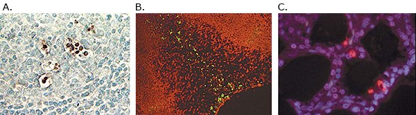 Detection of apoptotic cells Detection of apoptotic cells