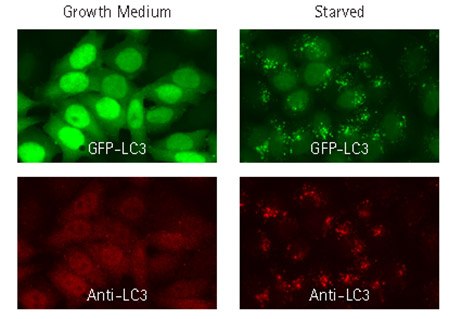 GFP-LC3 fluorescent signal (green) co-localizes with signal from fluorescent staining using LC3 antibody (red).  GFP-LC3 fluorescent signal (green) co-localizes with signal from fluorescent staining using LC3 antibody (red).