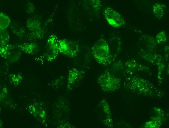 Live Cell LC3 Lentiviral Fluorescent Biosensors Live Cell LC3 Lentiviral Fluorescent Biosensors