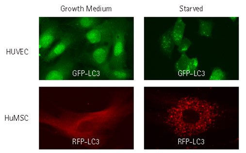 Lentiviral transduction of HUVEC and Human MSCs Lentiviral transduction of HUVEC and Human MSCs