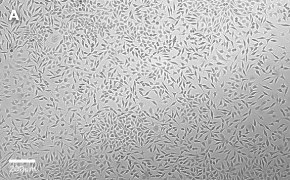 millicell-cell-lines-85011425-a