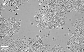 millicell-cell-lines-93021013-a