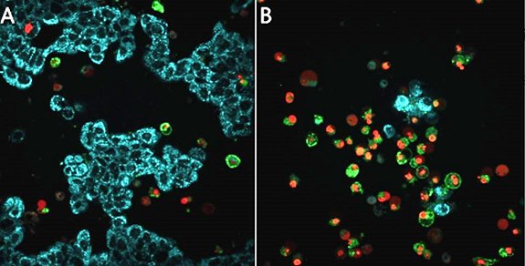 Live cell detection apoptosis in MCF-7 breast cancer cells Live cell detection apoptosis in MCF-7 breast cancer cells