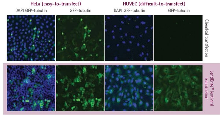 Plasmid vs. lentivirus transfection in easy- and difficult-to-transfect cell types. Plasmid vs. lentivirus transfection in easy- and difficult-to-transfect cell types.