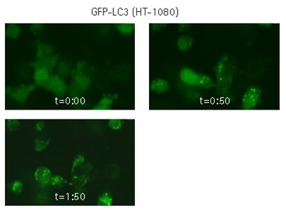 Live cell time-lapse imaging of lentivirally-transduced cells Live cell time-lapse imaging of lentivirally-transduced cells