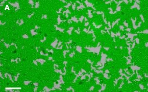 OSUMMER.10 cells imaged on Millicell<sup>®</sup> DCI Digital Cell Imager Brightfield imaging of OSUMMER.10 cells on Millicell<sup>®</sup> DCI Digital Cell Imager at 10X magnification