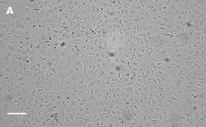 OSUMMER.8 cells imaged on Millicell<sup>®</sup> DCI Digital Cell Imager Brightfield imaging of OSUMMER.8 cells on Millicell<sup>®</sup> DCI Digital Cell Imager at 10X magnification