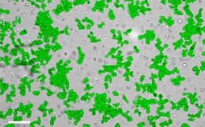 Masked Scp2 cells on Millicell<sup>®</sup> DCI Digital Cell Imager Brightfield imaging of Scp2 cells on Millicell<sup>®</sup> DCI Digital Cell Imager at 10X magnification with mask