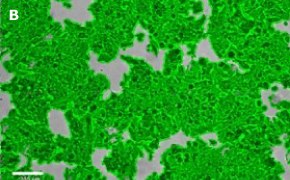 Masked MCF-7 BUS cells on Millicell<sup>®</sup> DCI Digital Cell Imager Brightfield imaging of MCF-7 BUS cells on Millicell<sup>®</sup> DCI Digital Cell Imager at 10X magnification with mask