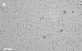 OSUMMER.9 cells imaged on Millicell<sup>®</sup> DCI Digital Cell Imager Brightfield imaging of OSUMMER.9 cells on Millicell<sup>®</sup> DCI Digital Cell Imager at 10X magnification