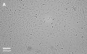 MG-63 cells imaged on Millicell<sup>®</sup> DCI Digital Cell Imager, 10X Brightfield imaging of MG-63 cells on Millicell<sup>®</sup> DCI Digital Cell Imager at 10X magnification