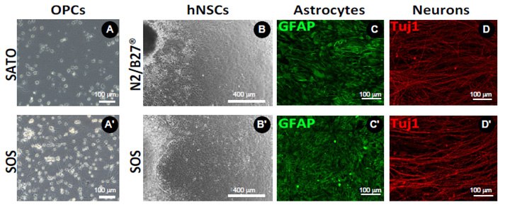 <b>A)</b> Comparison of the effects of DMEM/SATO vs. MEMO/SATO media on OPC morphology and proliferation. <b>B)</b> Comparison of neural epithelial cell differentiation from human iPSC generated embryonic bodies using serum free  bplements N2+B27 (top panels) or SOS (bottom panels) to generate neurons (β-III) and astrocytes (GFAP) after approximately 5 weeks of differentiation. BrightCell™ media preserves normal cell function of OPCs and human neural stem cells