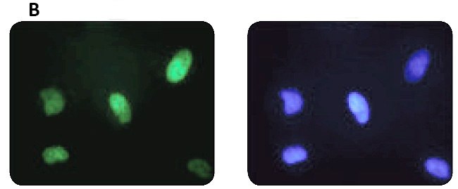 chemoresistance-changes-d Chemoresistance changes parallel HIF1α protein levels.