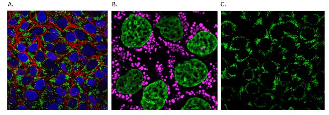 <b>A)</b> Live HeLa cells stained with BioTracker 488 Green Lipid Dye (SCT144), Hoechst (94403) and BioTracker 655 Red Cytoplasmic Membrane Dye (SCT108). <b>B)</b> HeLa cells stained with BioTracker 610 Red Lipid Droplet Dye (magenta) and BioTracker 488 Green Nuclear Dye (SCT120). <b>C)</b> HeLa cells stained with BioTracker 488 Green Lipid Dye (SCT144).  Live cell imaging of cellular lipids