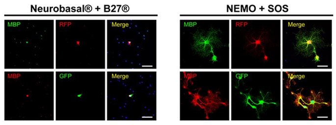 Successful FACs sorting, culturing and differentiation of viable MBP+ GFP/RFP labelled oligodendrocyte progenitor cells (OPCs) from adult mouse brain is only achievable with NEUMO and SOS compared to Neurobasal<sup>®</sup> and B27<sup>®</sup>. Fluorescent cell sorting of glial cells