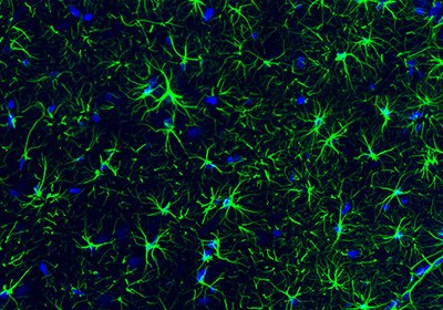 Neural Stem Cell Markers and Antibodies Immunofluorescence staining of rat hippocampus shows strong positivity of the astrocytes.