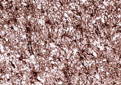 Neural Stem Cell Markers and Antibodies Immunohistochemical staining of the human cerebral cortex shows strong cytoplasmic positivity in astrocytes.