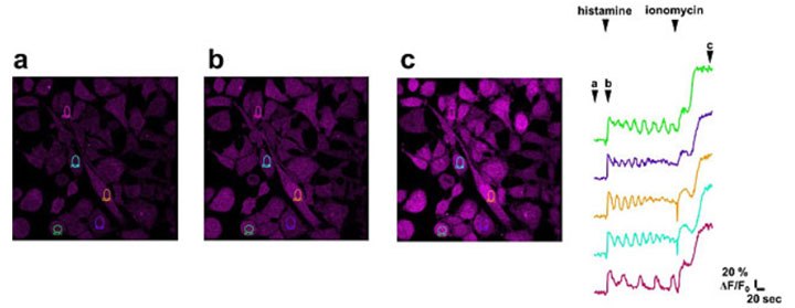 Imaging of calcium flux in cancer cells Imaging of calcium flux in cancer cells