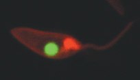 Leishmania donovani Leishmania donovani
