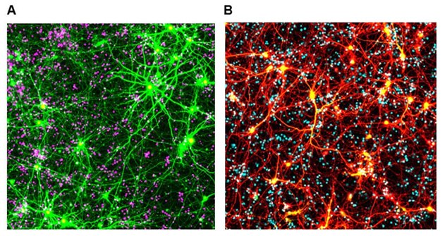 <b>A)</b> Primary rodent cortical neurons expressing mApple (EGFP) and a mutant gene Matrin3 (YFP) involved in familial amyotrophic lateral sclerosis, counter-stained with a nuclear dye (purple). <b>B)</b> Live primary rodent cortical neurons expressing mApple (red) and a mutated gene C9orf72 (yellow) involved in familial amyotrophic lateral sclerosis and frontotemporal dementia, stained with a nuclear dye (cyan). All neuronal cells grown in BrightCell™ NEUMO/SOS media. Live cell fluorescent imaging of neurons in BrightCell™ media (NEUMO/SOS)