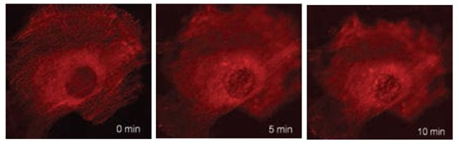 Live cell time-lapse imaging of β-actin Live cell time-lapse imaging of β-actin