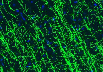 Neural Stem Cell Markers and Antibodies Immunofluorescence staining of rat hippocampus shows strong positivity of the astrocytes.