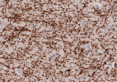 Neural Stem Cell Markers and Antibodies Immunohistochemical staining of the human cerebral cortex  .