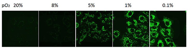 measurement-of-hypoxia-in-cancer-cells Measurement of hypoxia in cancer cells.