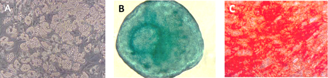 <b>A</b>) Lipid vesicle accumilation in adipocytes exhibit extensive intracellular lipid vacoule formation. <b>B</b>) Alcian Blue staining of chondrocytes and cartillage extracellular matrix. <b>C</b>) Alizarin Red S staining of calcium deposits in mineralized osteoblasts. Differentiation of multipotent bone-marrow derived hMSCs into adipocytes, chondrocytes and osteocytes
