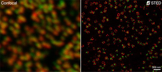 Confocal and STED images Two subunits of the nuclear pore complex were immunolabeled using antibodies against gp210 and antibodies with multiple specificities (PAN4/5) and secondary antibodies coupled to Abberior® STAR580 and Abberior® STAR635P.
