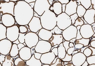 Immunohistochemical staining of human breast for Perilipin-1 using Anti-PLIN1 polyclonal antibody Immunohistochemical staining of human breast for Perilipin-1